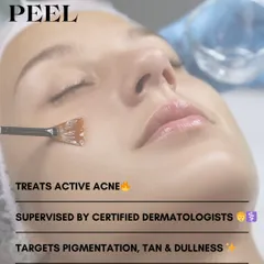 A chemical peel is a highly effective, dermatologist-supervised procedure for treating active acne. This treatment works by exfoliating the skin to clear clogged pores, reduce inflammation, and fade the pigmentation and tan that often accompany breakouts.