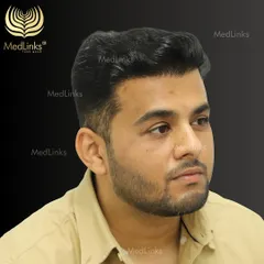 The final result of a successful hair transplant. Notice the natural density and the way the hair can be styled. We don't just add hair; we restore a look that is youthful and full of life.