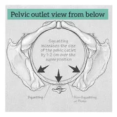 This diagram shows why squatting is so effective. It can increase the size of your pelvic outlet by 1 to 2 centimeters compared to lying on your back.