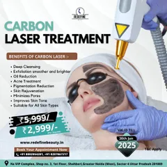 This graphic details a special offer for our Carbon Laser Treatment. It lists the many benefits, including deep cleansing, oil reduction, minimizing pores, and improving skin tone, making it suitable for all skin types.