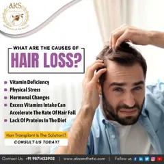 This graphic outlines some of the primary causes of hair loss. Factors like vitamin deficiencies, stress, hormonal changes, and lack of protein in your diet can all contribute to hair fall.