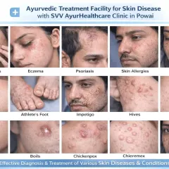 I treat a wide spectrum of skin diseases at my clinic. This collage shows some of the common conditions I can help you with, including acne, eczema, psoriasis, ringworm, and pigmentation issues like melasma. My goal is to provide an effective diagnosis and lasting treatment for your specific concern.