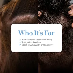 My hair and scalp treatments are for everyone. As this graphic shows, I specifically address concerns common in men, such as hair thinning and scalp inflammation, providing targeted solutions to restore hair health.