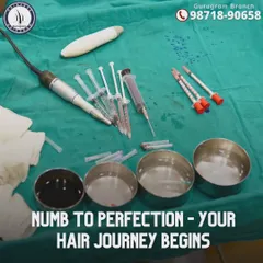Here you can see some of the sterile, precision tools we use for our hair restoration procedures. From local anesthesia to the FUE punch and implanters, every instrument is chosen to ensure your journey is safe, comfortable, and effective.
