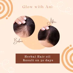 Just 30 days is all it takes to see a real difference. This is a real result from using my Herbal Hair Oil. It works by strengthening your roots and giving your scalp the nourishment it needs for healthy hair growth.