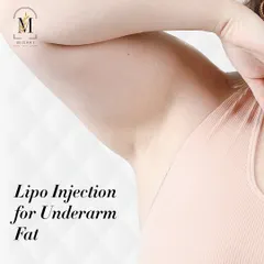 Many clients complain about stubborn underarm fat that no exercise can fix. For these small, specific areas, I use targeted Lipo Injections to precisely break down fat cells, resulting in a smoother, more defined contour.