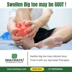 A swollen and painful big toe is a classic sign of gout. I offer specialized Ayurveda therapies to treat the inflammation and pain associated with this condition and address its underlying causes.