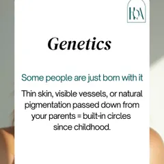 Sometimes, dark circles are simply genetic. Thin skin, visible blood vessels, or natural pigmentation passed down from your parents can create built-in circles that have been there since childhood and won't respond to topical creams.