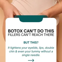 This is what Botox and fillers can't do. The Exilis treatment tightens your eyelids, lips, double chin, and even your tummy without a single needle. It's a breakthrough in non-surgical sculpting.