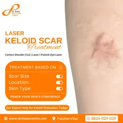 Keloids are a specific type of raised scar that requires a specialized approach. I utilize advanced CO2 and Pulsed-Dye lasers to carefully reduce their size and improve the skin's texture, customizing the treatment for each patient's needs.