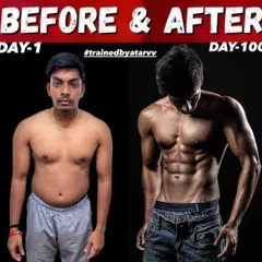 This client started with stretch marks and excess body fat. In 100 days, we completely transformed his physique, revealing a solid six-pack and muscular frame.