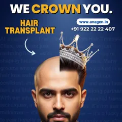 From bald to royal, we crown you. At our clinic, we don't just restore hair; we restore confidence and help you feel like royalty with a natural, dense hairline.