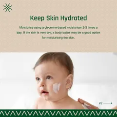 Keeping a baby's skin hydrated is especially important in winter. I suggest using a glycerine-based moisturizer 2-3 times a day. If the skin is very dry, a body butter can be a good option for extra nourishment.