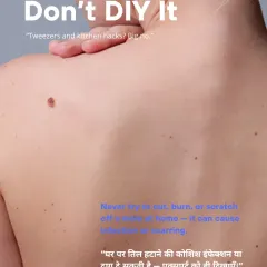 Please do not try to cut, burn, or scratch off a mole or skin tag at home. This is extremely dangerous and can lead to infection, significant scarring, and incomplete removal. Always see a professional.