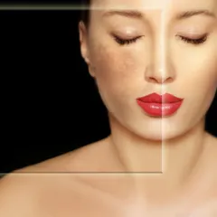 This visual represents the journey from uneven pigmentation to a clear, luminous complexion. Whether it's melasma or sun damage, the goal is to restore your skin's natural tone with a safe and scientifically-backed treatment plan.