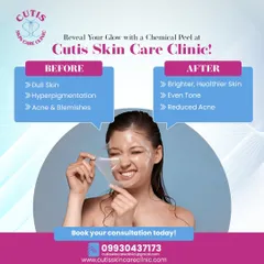 A before-and-after graphic illustrating the results of a Chemical Peel. It shows the transformation from dull, hyperpigmented, and blemish-prone skin to a brighter, even-toned, and healthier complexion.