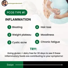 For inflammatory PCOS, symptoms often include bloating, cystic acne, and chronic fatigue. A great first step is to try eliminating common inflammatory foods like gluten and dairy for 30 days to see how your body responds.