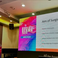 This slide from one of my presentations outlines the primary goals of any surgical treatment for Vitiligo. My aim is to replace the lost melanocytes, achieve near-complete repigmentation with excellent color matching, and ensure there is no disfigurement of either the donor or recipient skin areas.