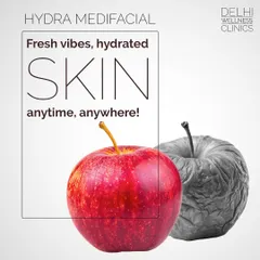 Just like an apple loses its freshness over time, our skin can lose its hydration. A Hydra Medifacial is the perfect solution to restore that fresh, hydrated glow, leaving your skin feeling revitalized anytime, anywhere.