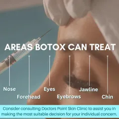 This graphic illustrates the versatility of Botox. We use it to treat various areas, including the forehead, eyes (crow's feet), jawline, chin, and even for a non-surgical brow lift.