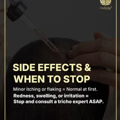 What about side effects? Minor itching or flaking can be normal at first. However, if you experience redness, swelling, or irritation, you should stop and consult a trichology expert immediately.
