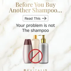 Before you buy another expensive hair fall shampoo, please read this. While the wrong shampoo can cause dryness or buildup, no shampoo can fix the root cause of hair loss. Treatment heals, shampoo only cleans.