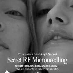 Secret RF Microneedling is your skin's best-kept secret for scars, fine lines, and skin laxity. It combines microneedling with radiofrequency to reveal smoother, tighter, and more radiant skin.