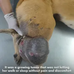 The growing tumor was causing her constant pain and discomfort, making it difficult to walk or even sleep. The size and severity of the growth required immediate surgical intervention.