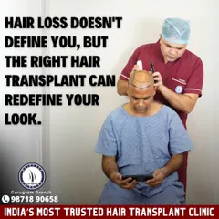 This image captures me during the critical hairline design phase. A successful transplant is not just about adding hair, it's about redefining your look with precision and artistry.