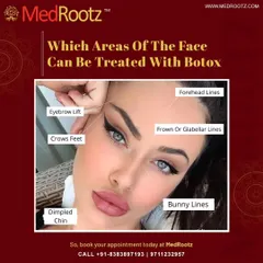 Botox is a precise tool for treating dynamic wrinkles caused by muscle movement. I commonly use it to address forehead lines, frown lines between the brows, and crow's feet, as well as for providing a subtle eyebrow lift.