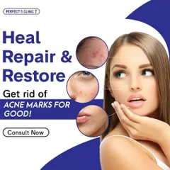 We focus on healing, repairing, and restoring your skin. This graphic illustrates how our treatments target and eliminate acne marks for good, helping you regain a smooth, clear complexion.