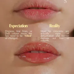 Many believe that dull or lined lips need fillers, but often the real issue is dehydration and barrier damage. This is where our Lip Meso ritual comes in. It is a targeted treatment designed to restore hydration and health from within for naturally soft, plump lips.