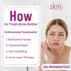If you're struggling with acne, there are professional treatments that deliver real results. I offer medicated facials, chemical peels, microneedling, and laser therapy to effectively manage and clear breakouts.