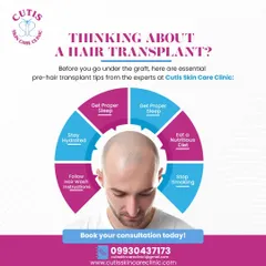 An essential guide for anyone considering a hair transplant. This infographic outlines key pre-procedure tips from our experts, including staying hydrated, eating a nutritious diet, and stopping smoking to ensure the best possible outcome.