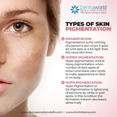 Skin pigmentation can be broadly categorized into three types. Hyperpigmentation means darkening of the skin, while hypopigmentation is the lightening of skin. Understanding which type you have is key to finding the right treatment.