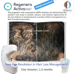 In just 1.5 months, this patient experienced significant hair rejuvenation after a single session of Regenera Activa. This shows how quickly our treatments can work to improve the appearance of thinning hair.