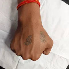 Before: Two small, faded Om symbol tattoos on the back of the hand. The client wanted a stronger, more prominent design.