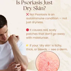 Many people mistake psoriasis for simple dry skin. This infographic explains the key difference: psoriasis is an autoimmune condition causing red, scaly patches that don't improve with moisturizer alone. If your 'dry skin' is thick or itchy, it's time to see a dermatologist.