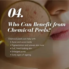 Who can benefit from a chemical peel? This visual guide shows how peels can effectively treat a range of concerns, including acne marks, uneven skin tone, dullness, enlarged pores, and early signs of aging.