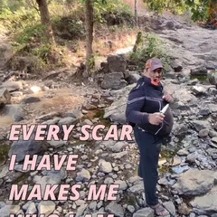 Every scar makes me who I am. This was taken during a one-day ride and train event with my warrior tribe at Tungareshwar.