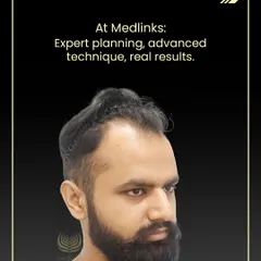 This is the 9-month result of a carefully planned hair restoration journey. The goal is always a natural-looking hairline and density that blends seamlessly.