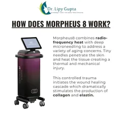How does it work? Morpheus8 combines radiofrequency heat with deep microneedling. This controlled thermal injury stimulates a powerful wound-healing response, dramatically increasing collagen and elastin production.