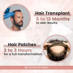 This graphic compares the timeline for a hair transplant versus a hair patch. A transplant is a long term investment that shows results in 6 to 12 months, while a patch offers an immediate transformation in just a few hours.