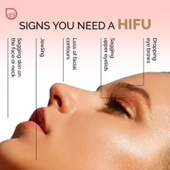 Are you seeing signs of sagging skin, jowling, or drooping eye brows? These are all indications that you could benefit from a HIFU treatment to lift and tighten the underlying structures of the face.