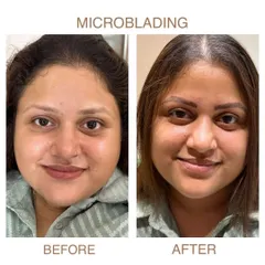 The power of a perfect brow. This before and after showcases our microblading service, where we create natural, symmetrical, and fuller-looking eyebrows that frame the face perfectly.