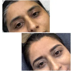 If you love a soft, powdered makeup look, ombre brows are for you. See how this transformation gives the brows a beautiful, defined shape without any harsh lines, just a gentle gradient of color.