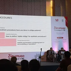 Here I am serving as a panelist for the Vitiligo Foundation of India. We discussed the careful considerations for performing aesthetic procedures like laser hair removal on patients with vitiligo. This highlights my focus on medical dermatology, ensuring every procedure is conducted with the utmost safety and patient care in mind.