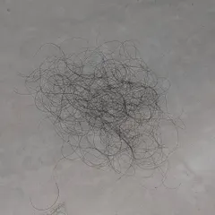 This is another visual of 100 shed hairs on a flat surface. Don't waste time on ineffective remedies if you are losing more than this; a proper diagnosis is key to an effective treatment plan.