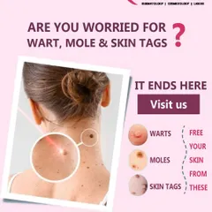 This graphic provides an overview of the common skin growths I treat, including warts, moles, and skin tags. My clinic offers specialized procedures for each of these conditions to restore clear, smooth skin safely.