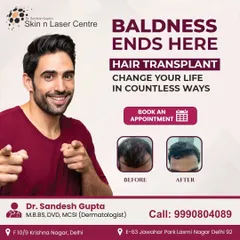 Before and after images show the transformative power of a hair transplant. It's not just about hair, it's about changing your look and boosting your confidence.